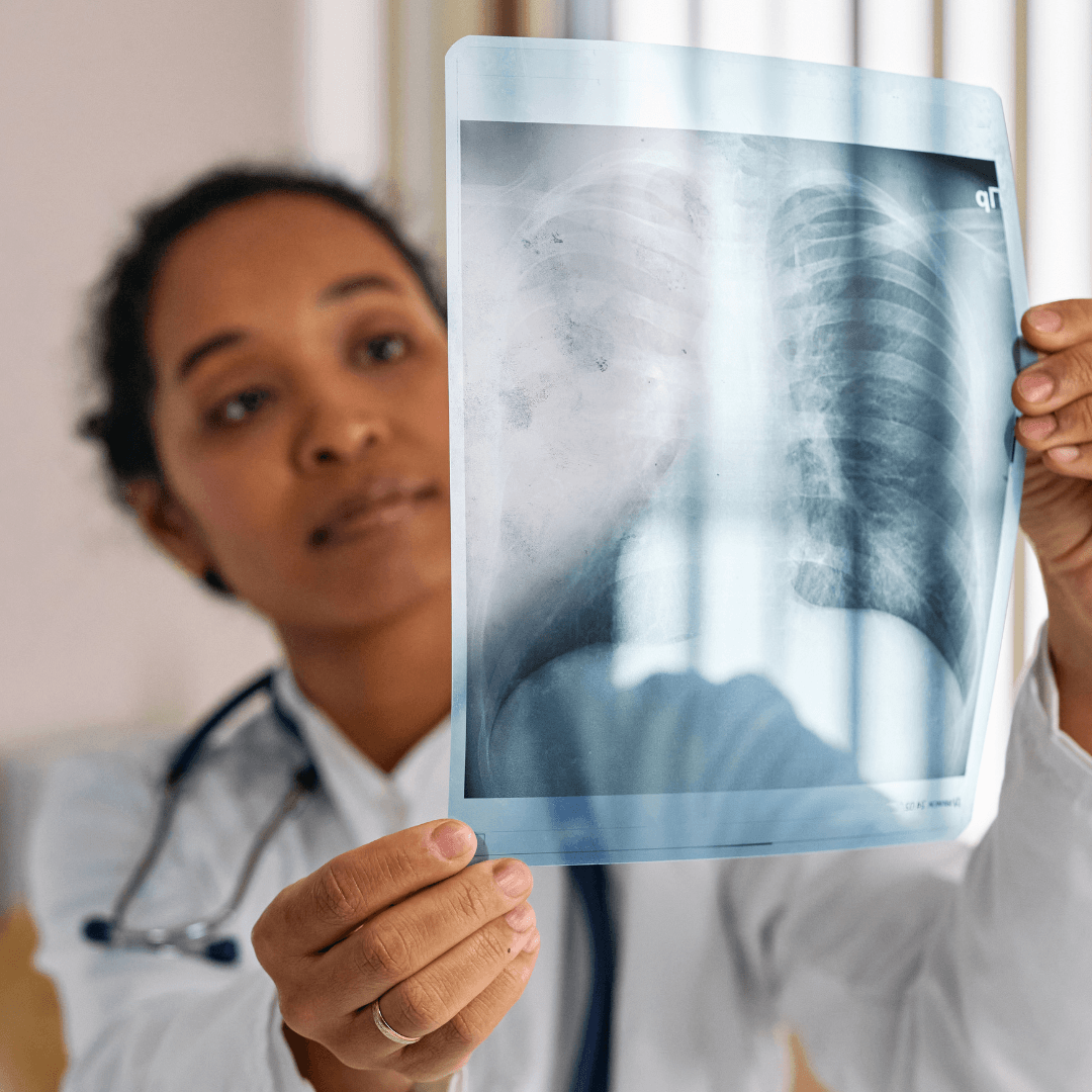 A doctor wearing a white coat and stethoscope examines a chest X-ray, holding it up to the light for a clearer view of the lung area—demonstrating the careful analysis and evidence-based practice central to the Launching Futures Toolkit.
